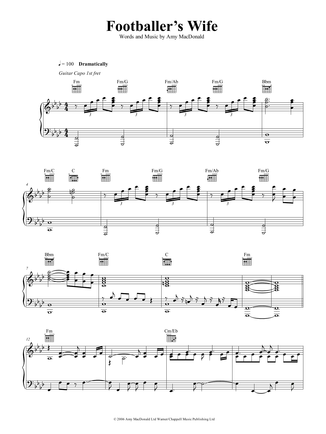 Amy MacDonald The Footballer's Wife sheet music notes and chords arranged for Piano, Vocal & Guitar Chords (Right-Hand Melody)