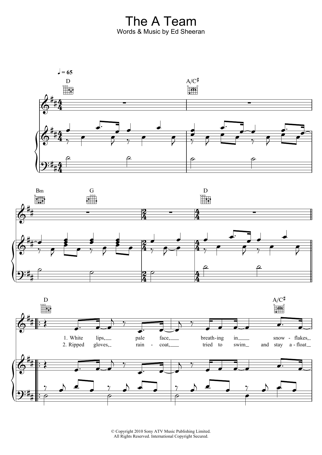 Birdy The A Team sheet music notes and chords arranged for Piano, Vocal & Guitar Chords