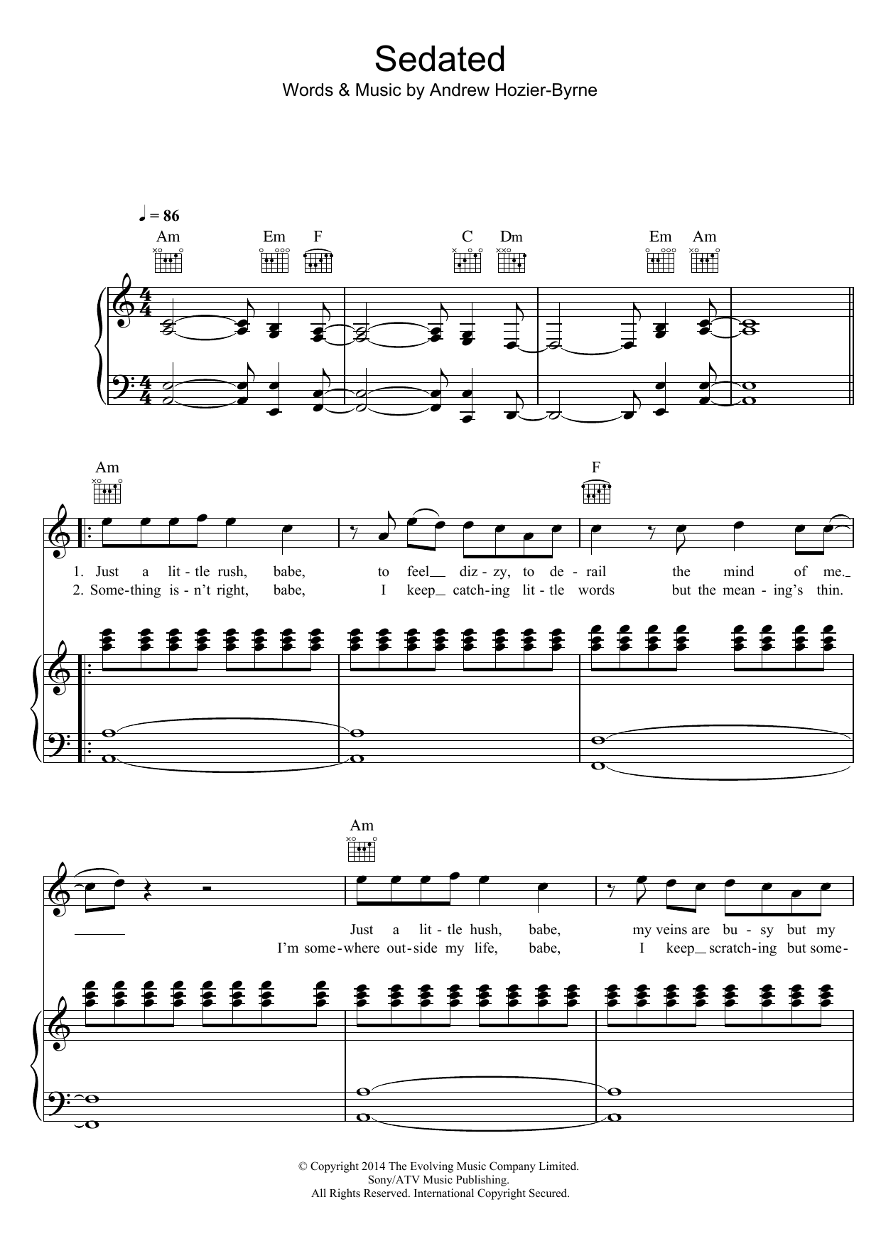 Hozier Sedated sheet music notes and chords arranged for Piano, Vocal & Guitar Chords
