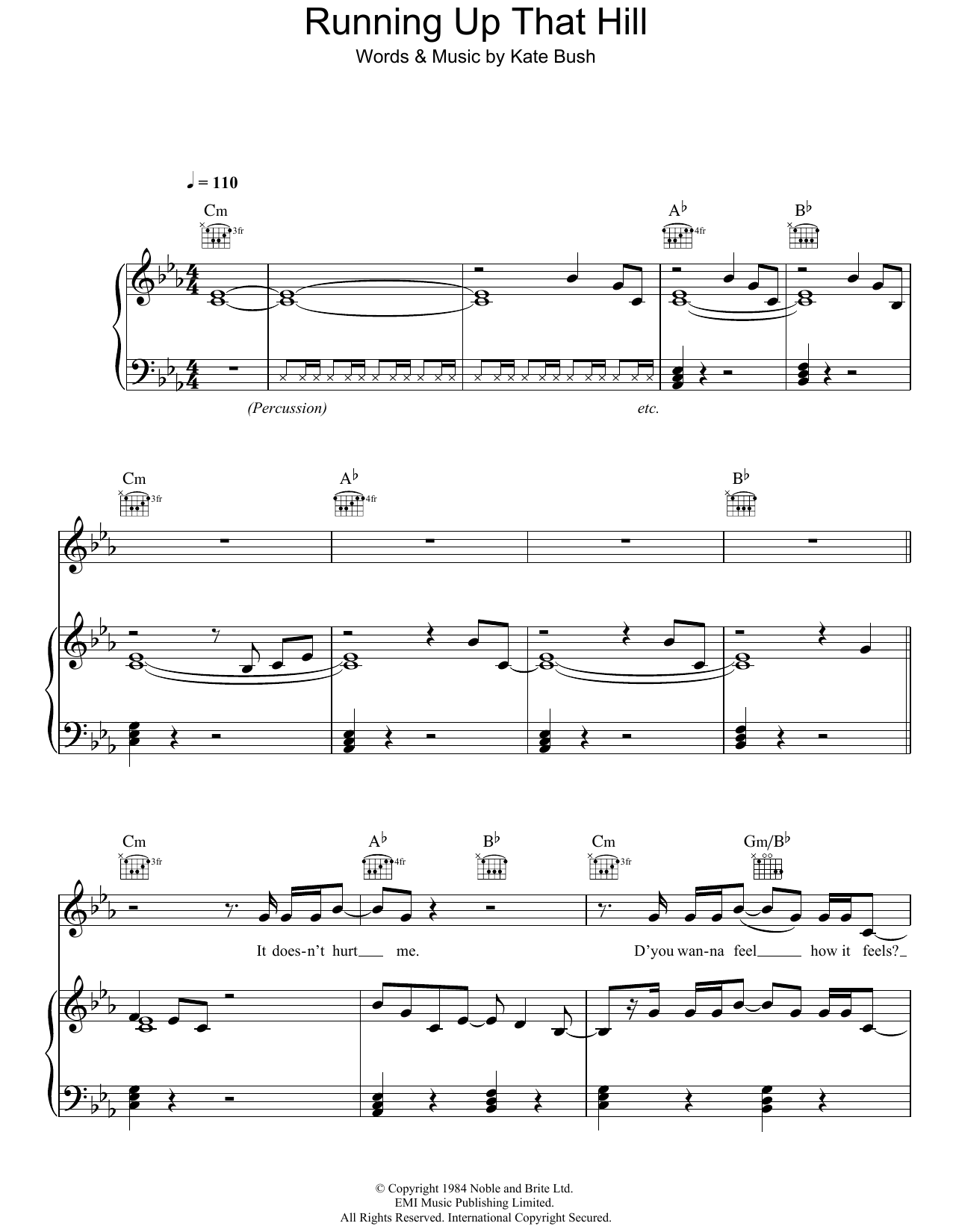 Easily Download Kate Bush Printable PDF piano music notes, guitar tabs for Piano, Vocal & Guitar Chords (Right-Hand Melody). Transpose or transcribe this score in no time - Learn how to play song progression.